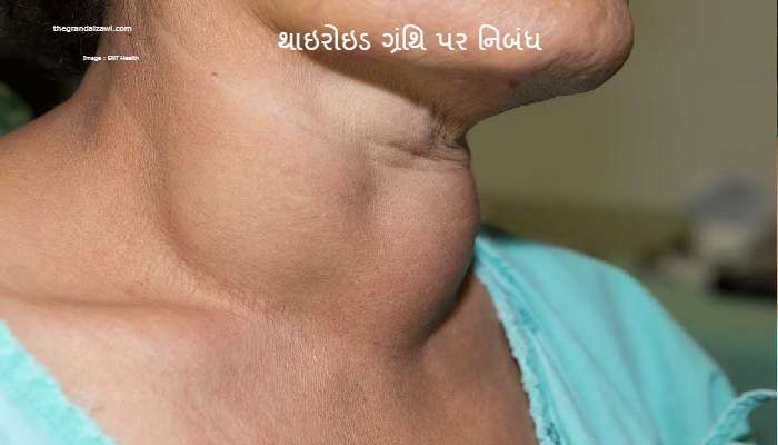 Thyroid Gland Essay In Gujarati 2023 થાઇરોઇડ ગ્રંથિ પર નિબંધ